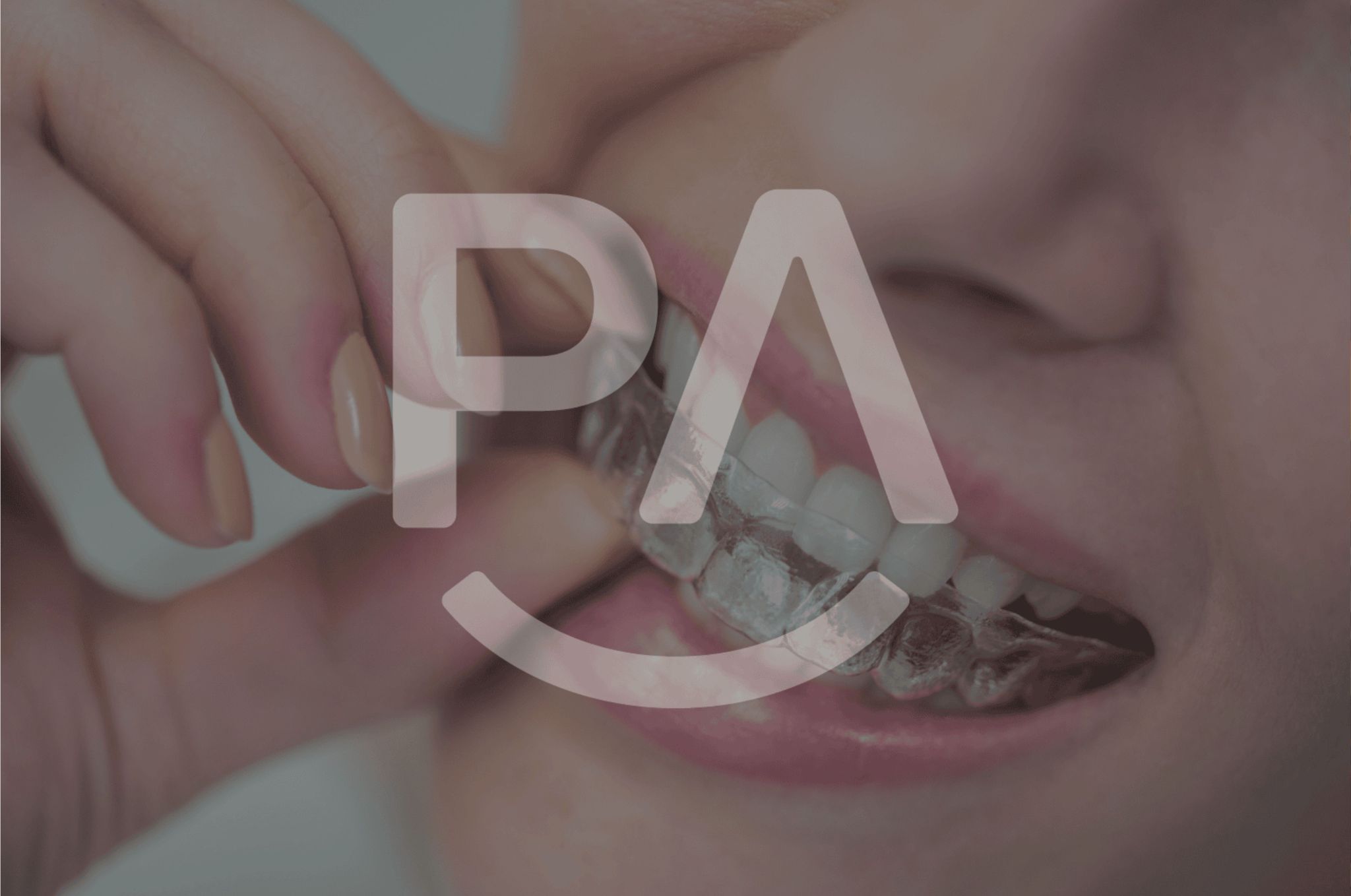 L'Impact de ParisAline : Au-delà de Simples Dents Alignées